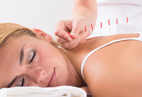 Acupuncture for auto accident injury
